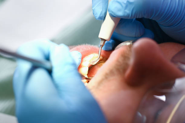 Best Emergency Dental Care for Trauma or Injury in Mayfield, PA