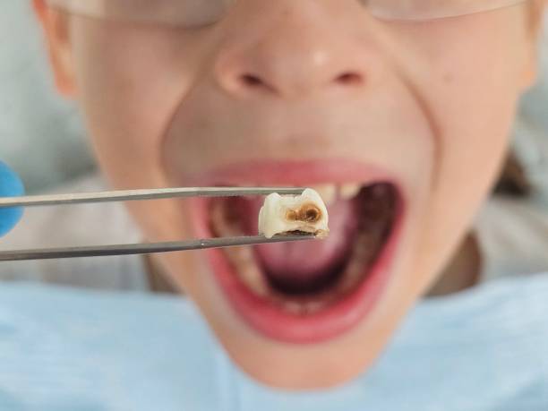 Best Same-Day Emergency Dentist in Mayfield, PA